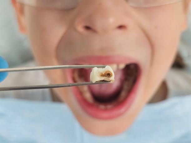 Best Broken or Chipped Tooth Repair in Scotts Hill, TN